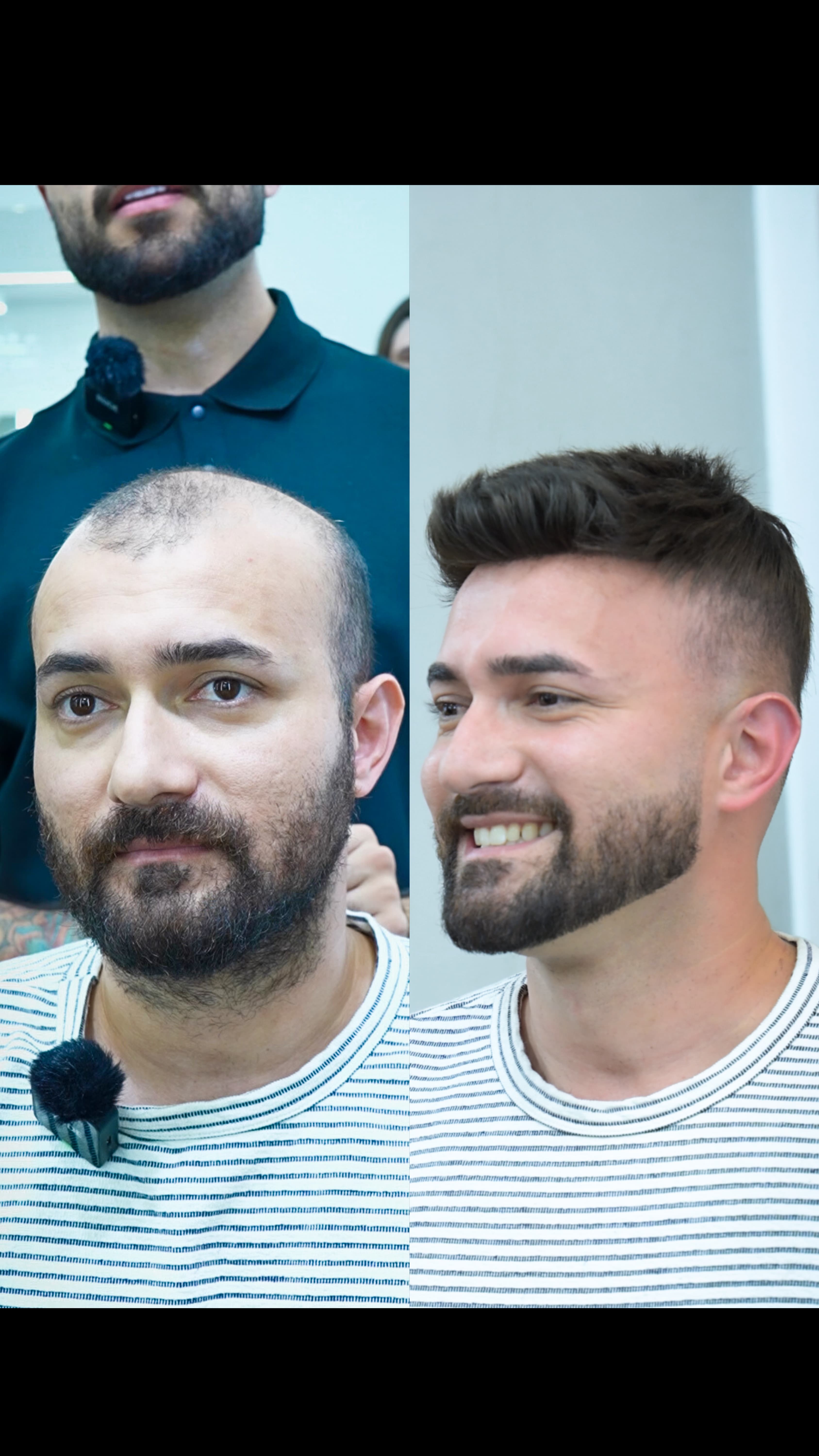 Antes e depois de um cliente atendido nas clínicas Francisco